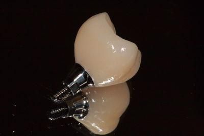 Screwed-Retained Implant Crown From China Dental Lab