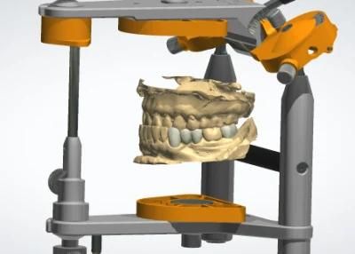 Dental Exocad Smile Design