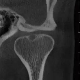 Hires 3D-Plus CE Professional Large Fov Dental 3D Cone Beam Computred Tomography Cbct Equipment