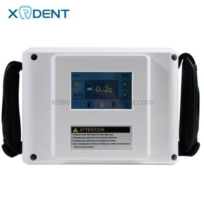 Popular High-Frequency Digital Portable Dental X-ray Tube X Ray Unit Portable with Dental Digital Sensor