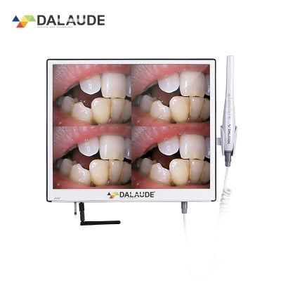 Dental Equipment Digital Dental Intraoral Cameras Mouth Watch Viewer