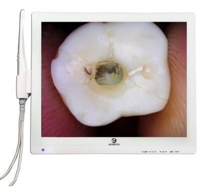 Video Recording Dental Intraoral Camera with 17 Inch Multimedia Monitor