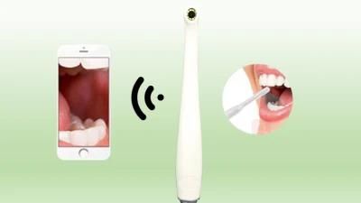 Scan Code to View Photos of Dental Intraoral Camera