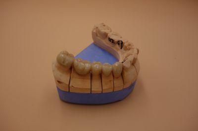 Dental Full Contour Zirconia Crown From China Dental Lab