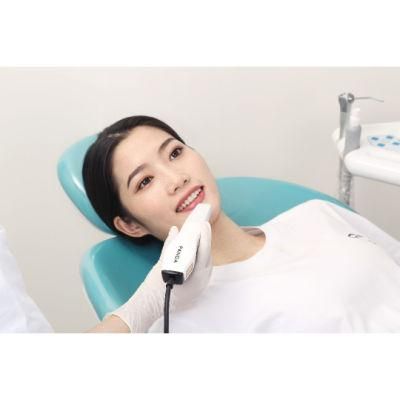 Cheap CAD Cam 3D Digital Dental Intra Oral Scanner Shinning