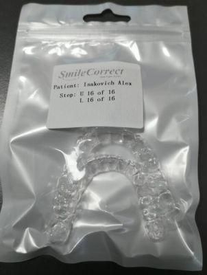 Smart Aligners/Best Teeth Aligners/Best Teeth Straightening/Crooked Teeth Treatment