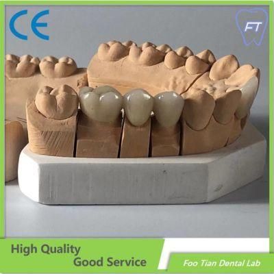Bridge and Zirconium Crown Custom Dental Material Lab Implant Full Contour