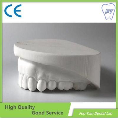 Professional Services Removable Metal Denture Cast Partial Framework Dental