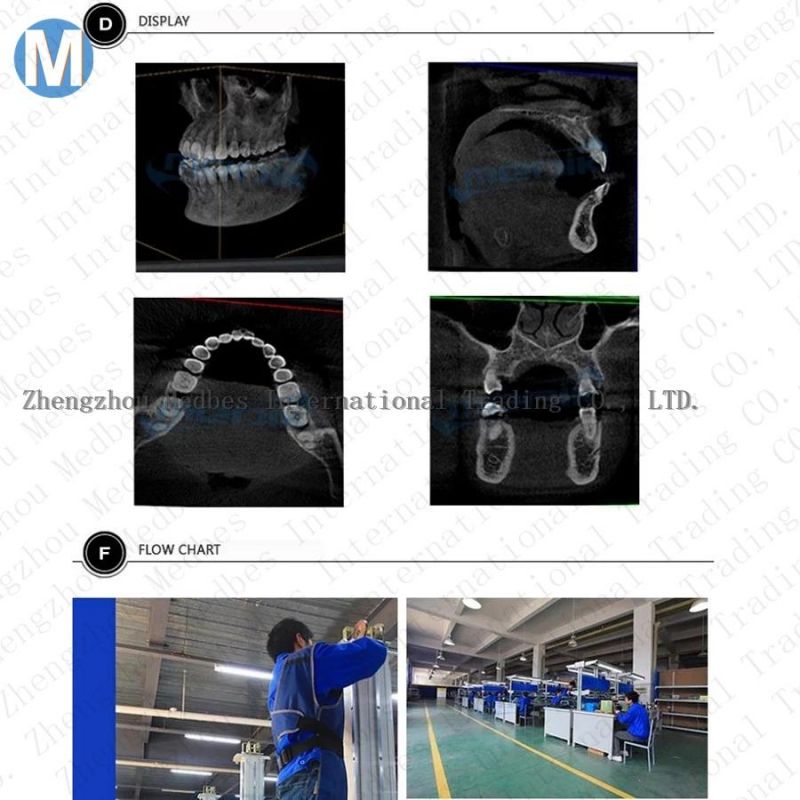 Fy-Q-III Panoramic Dental X Ray Ddental Intraoral Scanner