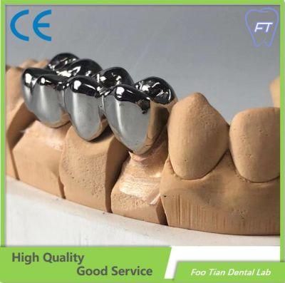 Dental Metal Ceramic Crown Dental Implant Customized