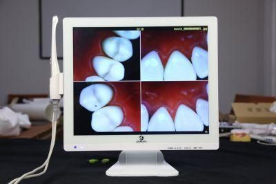 Dentist Preferred Super Clear Dental Oral Camera with 17 Inch Multimedia Monitor