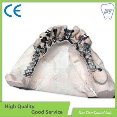 Customized CAD/Cam Vitallium Metal Cast Partial Dentures From China Dental Lab
