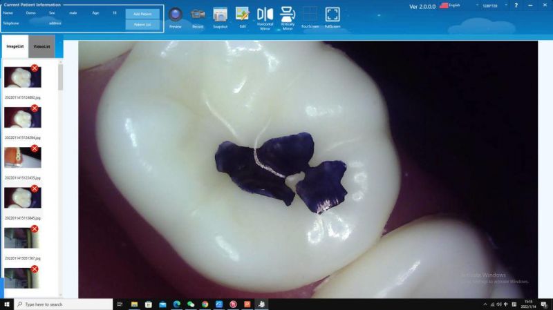 Plug and Play USB Dental Camera 1080P with Free Windows Software