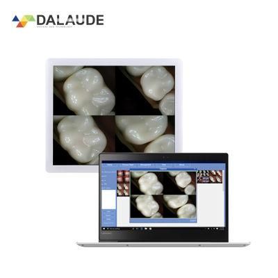 Nice Light Weight Intraoral Camera Oral Endoscope Install on Dental Chair