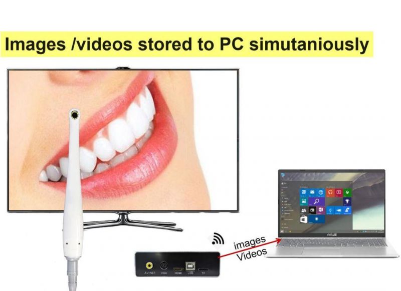 1080P TV Oral Camera Super Clear Image Vivid Show on Big Screen