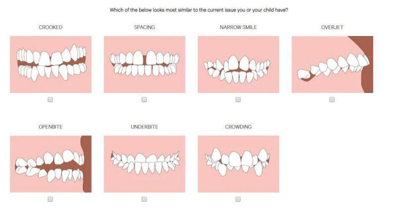 OEM Teeth Aligner Dental 3D Clear Aligners Orthodontics Brace with Quality Certifications