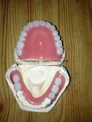 Acrylic Denture