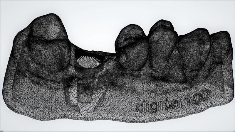 Digital Dental Implant Supplies Ceramiccrown Material Instrument Made From China Dental Lab Dental Implant