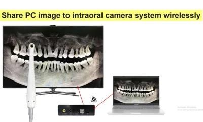 PC Wireless Storage Dental Intraoral Camera VGA/AV/Hdm-I Port to TV Big Screen Image Show