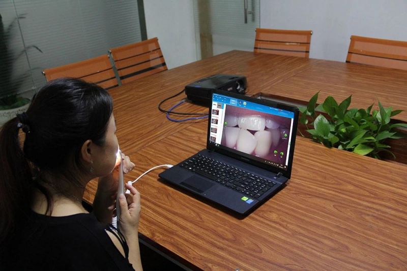 UVC Protocol Windows/Android Dental Intraoral Camera for Dentist