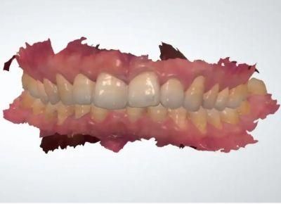 Best Dental Teaching Equipment 3D Oral Scanner High Precision Image Scanner