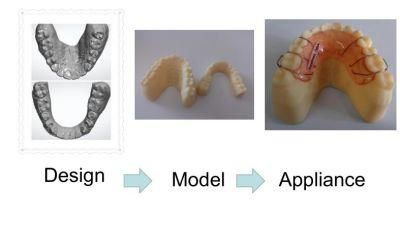 Dental Orthodontic Appliance From Midway Dental Lab