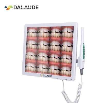 China Gold Producer Digital Camera Teeth Watch Compatible with Dental Chair