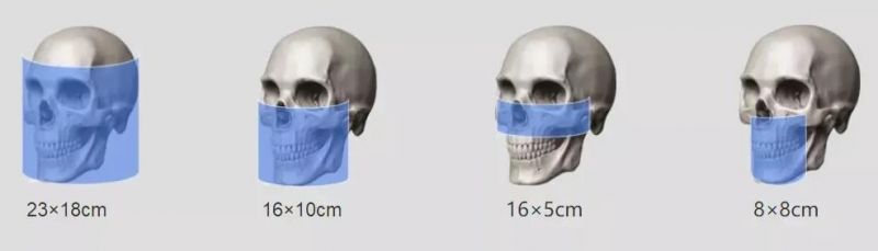 Hires3d-Max The Largest Fov Professional X-ray Dental Cbct Machine