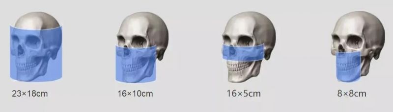 Hires3d-Max The Largest Fov Professional X-ray Dental Cbct Machine