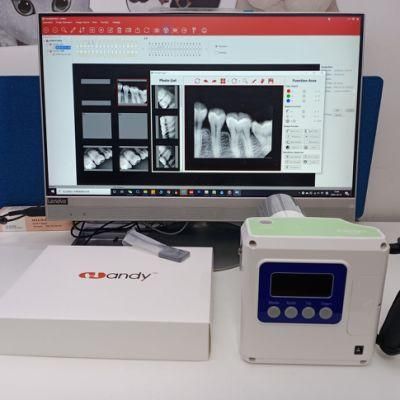 Professional Dental Supplies Top Product Portable Digital Dental X Ray Equipment