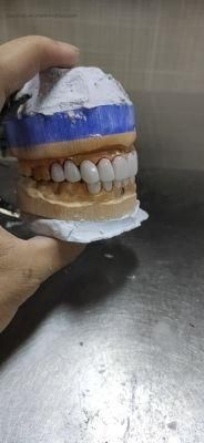 Dental Veneers in Cosmetic Dentistry Made in China Dental Lab Full Denture