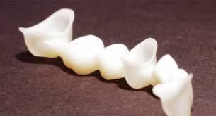 Dental Ceramic Crown From China Dental Lab