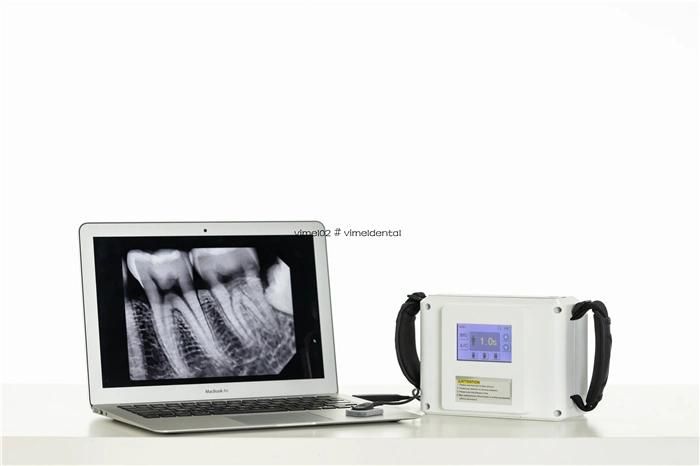 Dental Portable X Ray Unit Machine Hospital Medical Equipment
