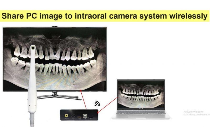 1080P TV Oral Camera Super Clear Image Vivid Show on Big Screen