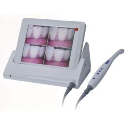 Dental Care Suitable for NTSC /PAL Intraoral Cameras for Dentistry