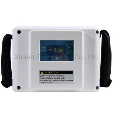 Touch Screen Portable X-ray Unit Digital Dental X Ray Toshiba Tube
