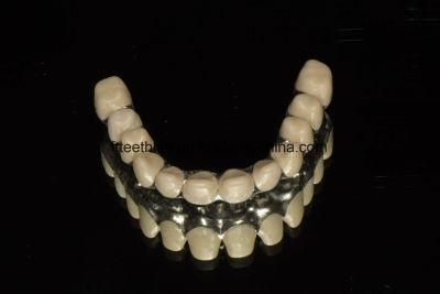 Dental Malo Bridge with Zirconia Crowns From China Dental Lab