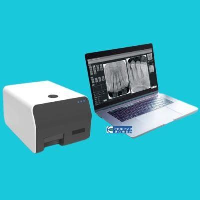 High-Quality Dental X-ray Scanner Digital 3D Imaging Dental Reader