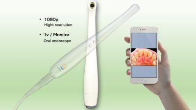 Intraoral Camera 1080P HD Photos Are Displayed on TV or Monitor