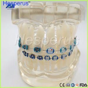 Dental Orthodontics Typodont Teeth Model Half Metal Half Ceramic Brace Bracket Typodont with Arch Wire Hesperus