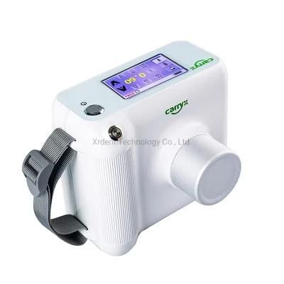 Direct Imaging High Frequency Portable Digital Dental X-ray Machine Price