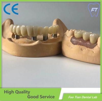 Dental Products Full Arch Metal Ceramic Implant Bridge with Cemented Retained