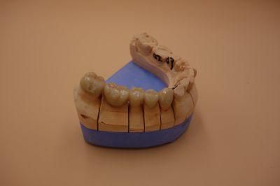 Zirconia Crown From China Dental Laboratory