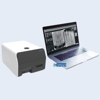 Digital Dental X-ray Image Plate Scanner, Dental Scanner Digital Dental Cr Imaging System, Dental Digital X-ray Phosphor Plate (PSP) Scanner