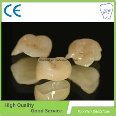 OEM Zirconia Crown Made From China Dental Lab with Aesthetic and Natural Looking