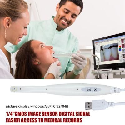 High Pixel CE Approved 1080P USB Intraoral Camera with 6 LEDs