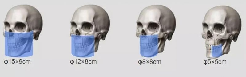 Smart 3D 3-in-1 Multifunctional Digital Dental Cbct Machine with True Mar Correction Module