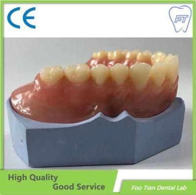 Hot Sale Removable Denture Cobalt Chrome Casting Framework Customized