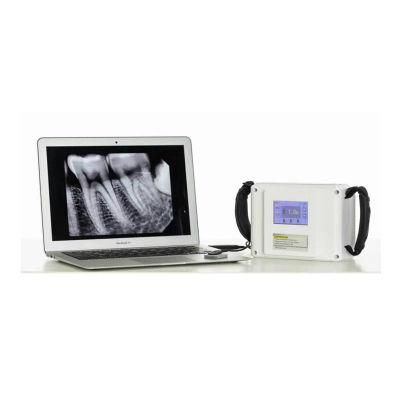 Intra-Oral X Ray Machine/Dental Portable Digital X-ray Machine with Good Price