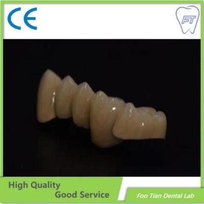 Good Service Zirconia Crown and Bridge Made From China Dental Lab